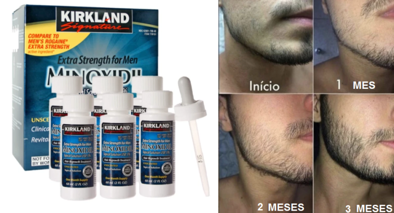 Minoxidil Tienda 1338